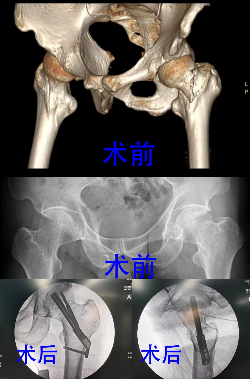 菏泽医专附属医院
